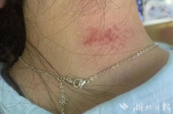 高毒性重金属超标，有东谈主已中招！请示：不要永劫期战役